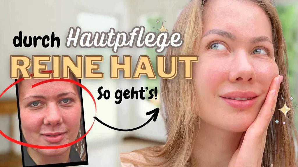 Gelöst: Hautpflege gegen Pickel, unreine Haut & Akne