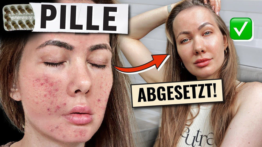 Akne nach Absetzen der Pille schnell loswerden