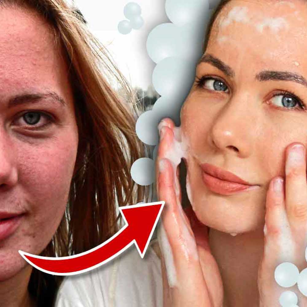 Die beste Gesichtsreinigung bei unreiner Haut
