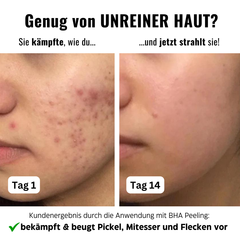 
                      
                        Porenfeines 4% BHA PEELING
                      
                    