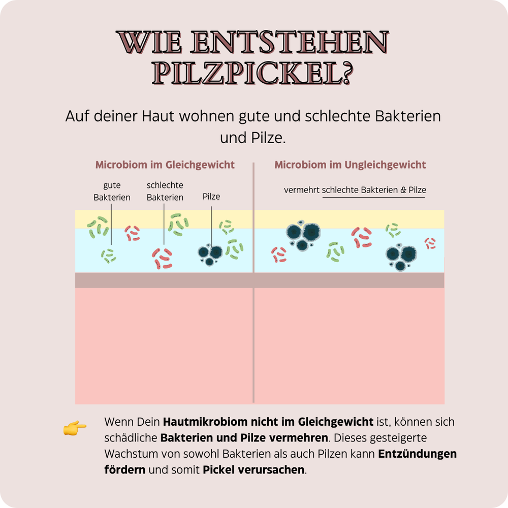 
                      
                        🍄 Mini-Pickel & Unterlagerungen Set
                      
                    