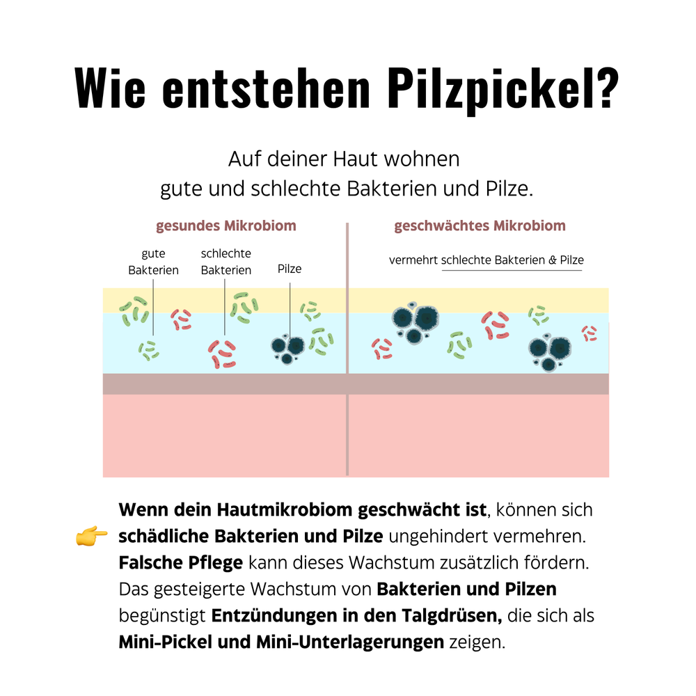 
                      
                        🍄 Mini-Pickel & Unterlagerungen Set
                      
                    