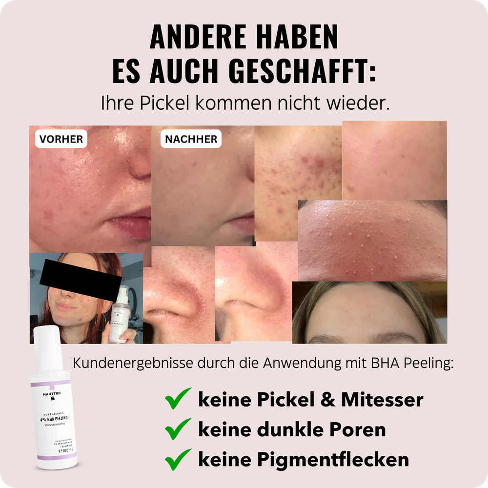 
                      
                        Porenfeines 4% BHA PEELING
                      
                    