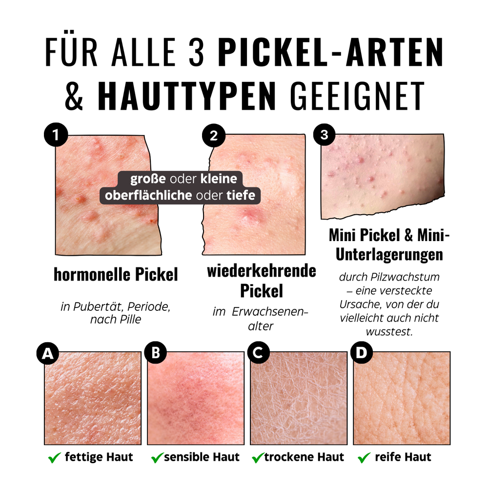 
                      
                        Porenfeines 4% BHA PEELING
                      
                    