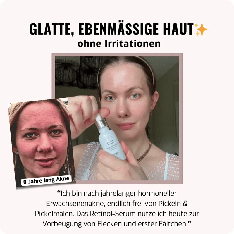 
                      
                        2% Retinol Serum
                      
                    
